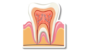 Root Canal Therapy In Galveston