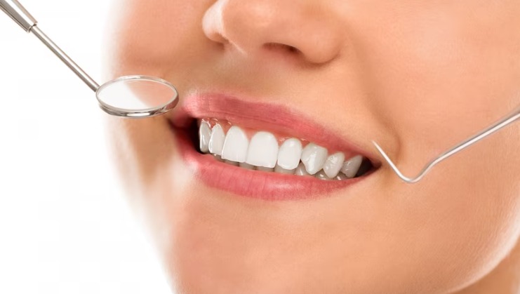 teeth whitening in Galveston