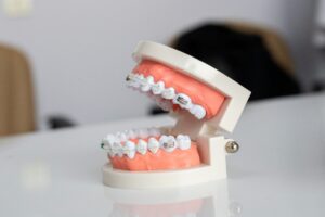 Cheap Dentist for Extractions in Galveston